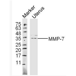 MMP7基质金属蛋白酶-7抗体