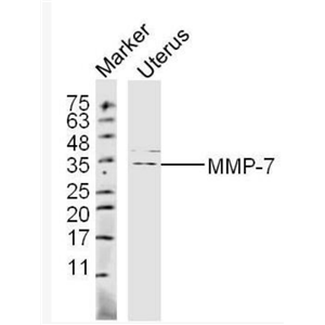 MMP7 基质金属蛋白酶-7抗体,MMP7