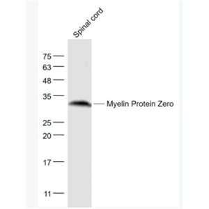 Myelin Protein Zero 外周髓磷脂P0蛋白/P0蛋白抗体