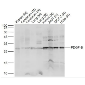 PDGF-B 血小板源性生长因子-B抗体,PDGF-B
