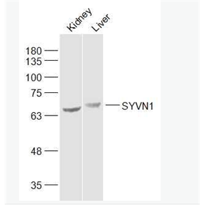 SYVN1 滑膜细胞凋亡抑制物1抗体,SYVN1