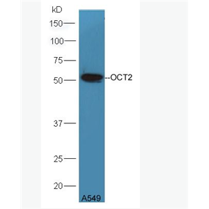 OCT2 阳离子转运蛋白2抗体,OCT2