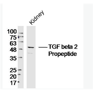 TGF beta 2 Propeptide 转移生长因子β2抗体