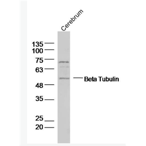 Beta Tubulin 微管蛋白抗体,Beta Tubulin