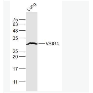 VSIG4 T淋巴细胞负调节蛋白抗体