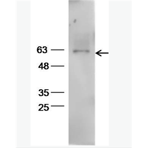 Aromatase 细胞色素P450 19抗体,Aromatase