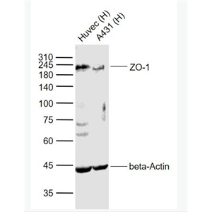 ZO-1/TJP1 胞质紧密粘连蛋白1/闭锁小带蛋白1抗体,ZO-1/TJP1