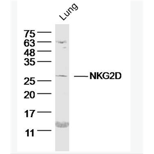 NKG2D NK细胞受体2D（CD314）抗体