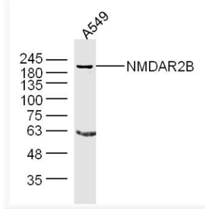 NMDAR2B 谷氨酸受体2B抗体,NMDAR2B
