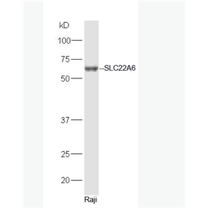 OAT1 / SLC22A6 阴离子转运蛋白-1抗体