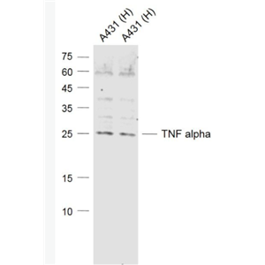 TNF alpha 肿瘤坏死因子-α抗体