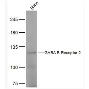 GABBR2  G氨基丁酸B型受体2抗体