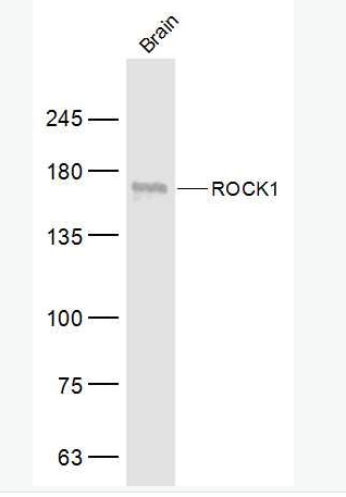 ROCK1 Rho相关蛋白激酶1抗体,ROCK1