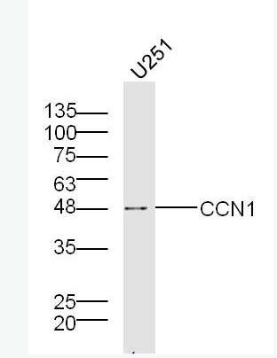 CCN1 富半胱氨酸肝素结合蛋白61抗体,CCN1