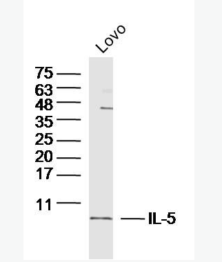 IL-5 白细胞介素5抗体,IL-5
