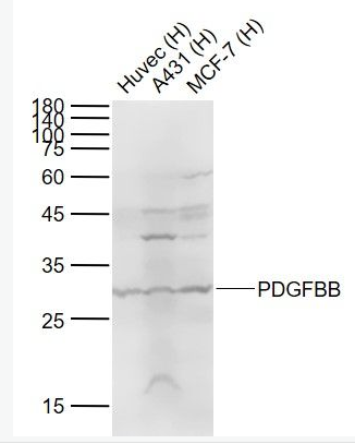 PDGFBB 血小板源性生长因子BB抗体,PDGFBB