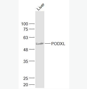 PODXL 足细胞特异蛋白抗体,PODXL