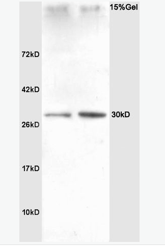 SNAI2 鋅指轉(zhuǎn)錄因子Slug抗體,SNAI2