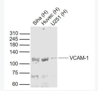 VCAM1 血管内皮细胞粘附分子（CD106）抗体,VCAM1