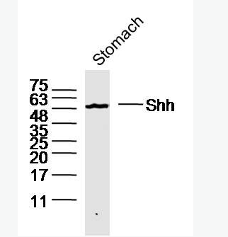 Shh Shh信号转导通路膜蛋白受体抗体,Shh