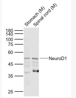 NEUROD1 神經(jīng)細(xì)胞分化因子1抗體,NEUROD1