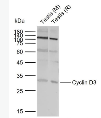 Cyclin D3 周期素D3抗体,Cyclin D3