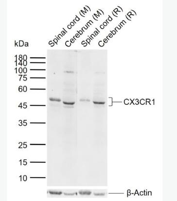 CX3CR1 趨化因子受體1抗體,CX3CR1