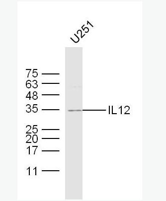 IL12 白介素12抗体,IL12