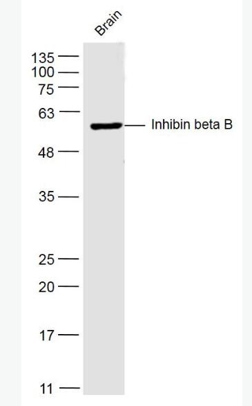 Inhibin beta B 抑制素βB/Inhibin β B抗體,Inhibin beta B