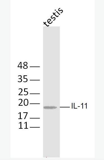 IL-11 白介素11抗体,IL-11