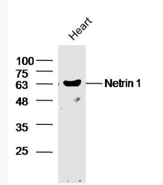 Netrin 1 轴突导向因子1抗体,Netrin 1