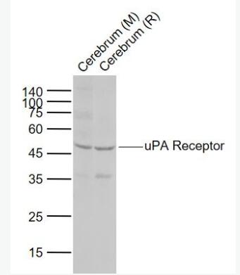 PLAUR 尿激酶型纤溶酶原激活因子受体（CD87）抗体,PLAUR