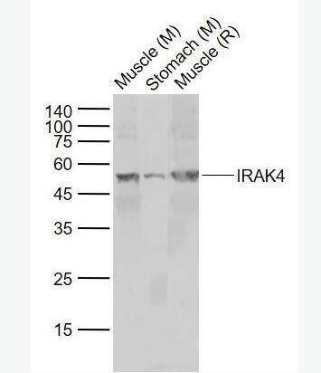 IRAK4 白介素-1受体相关激酶4抗体,IRAK4
