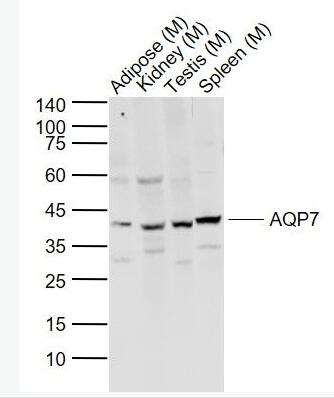 AQP7 水通道蛋白-7抗体,AQP7