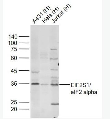 EIF2S1 真核啟動(dòng)因子2α抗體(eIFα2)抗體,EIF2S1