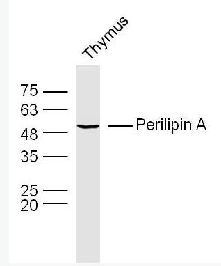 Perilipin A 脂滴包被蛋白Perilipin-A抗體,Perilipin A