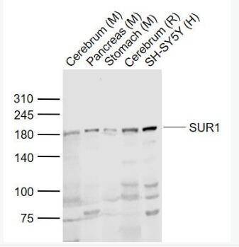 SUR1 磺酰脲类药物受体1抗体,SUR1
