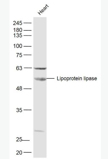 Lipoprotein lipase 脂蛋白脂酶抗体,Lipoprotein lipase