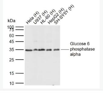 G6PC 葡萄糖6磷酸酶α/G6Pase-α抗体,G6PC