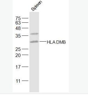 HLA-DPB1 组织相容性复合体2抗体,HLA-DPB1