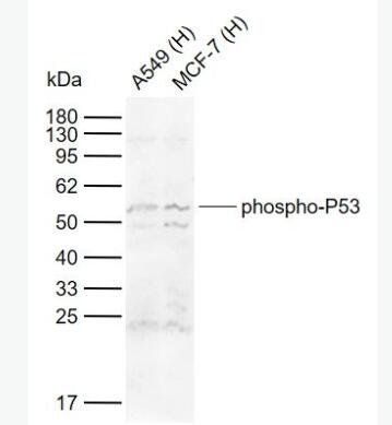 phospho-P53 (Ser15) 磷酸化肿瘤抑制基因P53抗体,phospho-P53 (Ser15)