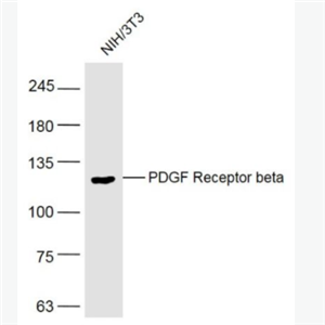PDGF Receptor beta 血小板源性生长因子受体B/PDGFRβ抗体