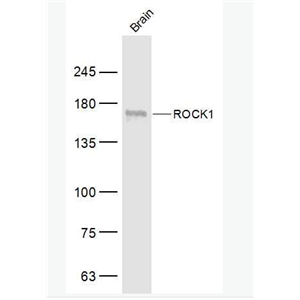 ROCK1 Rho相关蛋白激酶1抗体