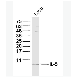 IL-5 白细胞介素5抗体