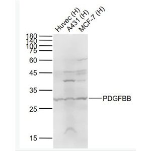 PDGFBB 血小板源性生长因子BB抗体