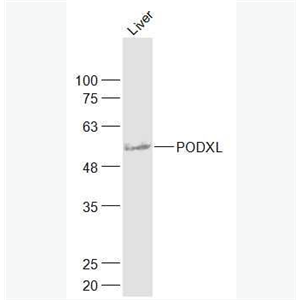PODXL 足细胞特异蛋白抗体