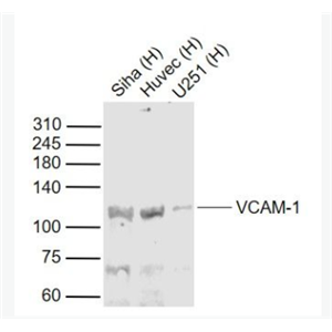 VCAM1 血管内皮细胞粘附分子（CD106）抗体