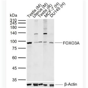 FOXO3A 叉头蛋白O3A抗体