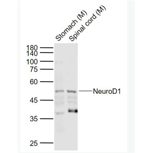 NEUROD1 神经细胞分化因子1抗体