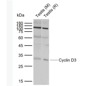 Cyclin D3 周期素D3抗体,Cyclin D3